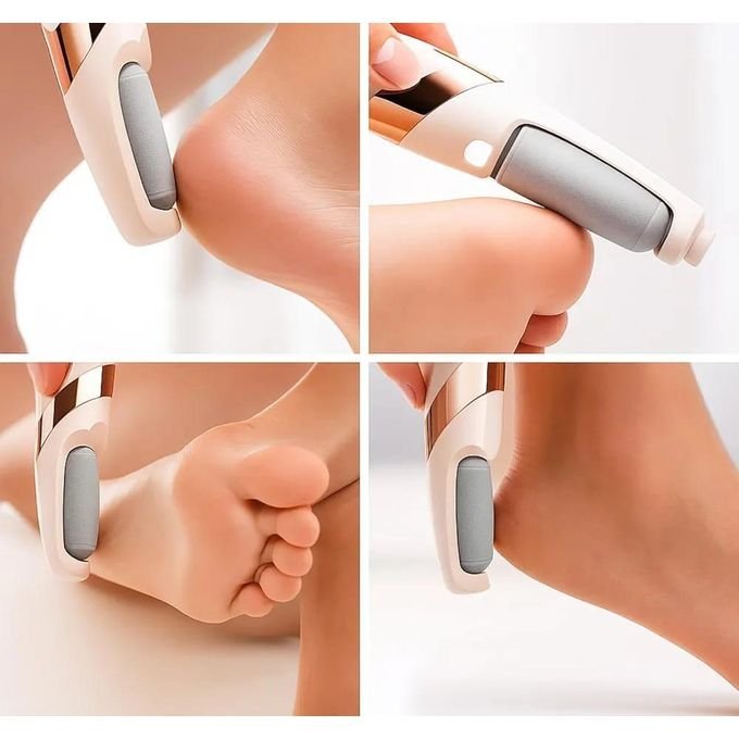 Flawless Pedicure Tool, Rechargeable & Cordless, Removes Calluses, Remove Hard, Dry & Cracked Skin on Feet, Two Speeds, Two Heads, Built-In LED Light